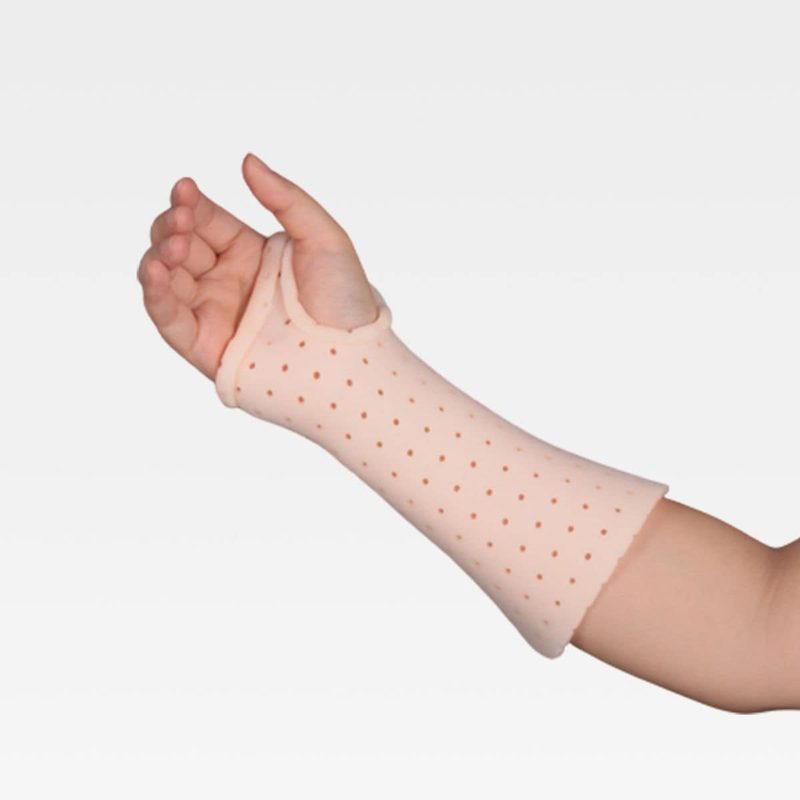 Forearm wearing a custom perforated splint